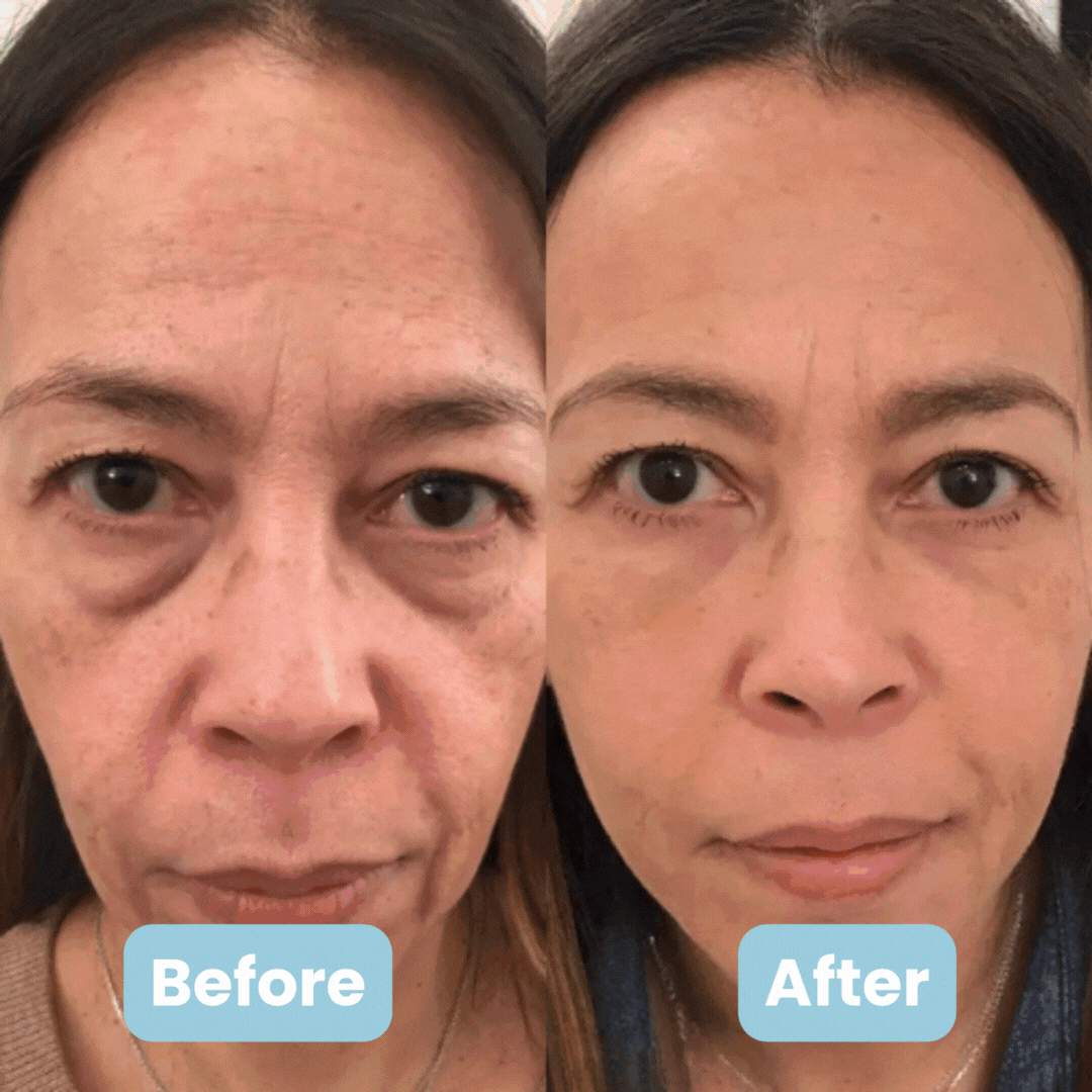 DERMAWELL 3-in-1 LED Facial Sculptor + 4 FREE Gifts