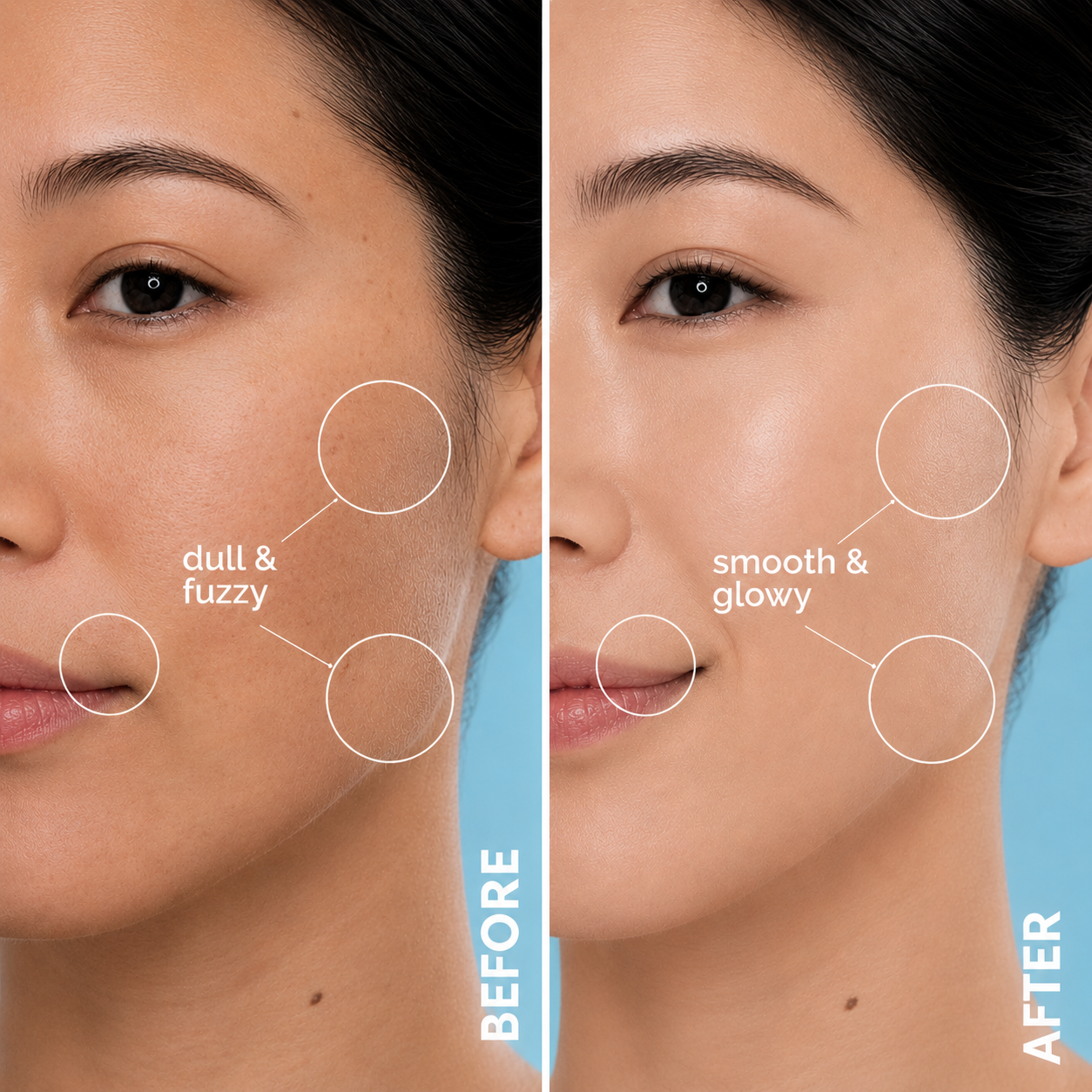 Sonic Dermaplaning Tool