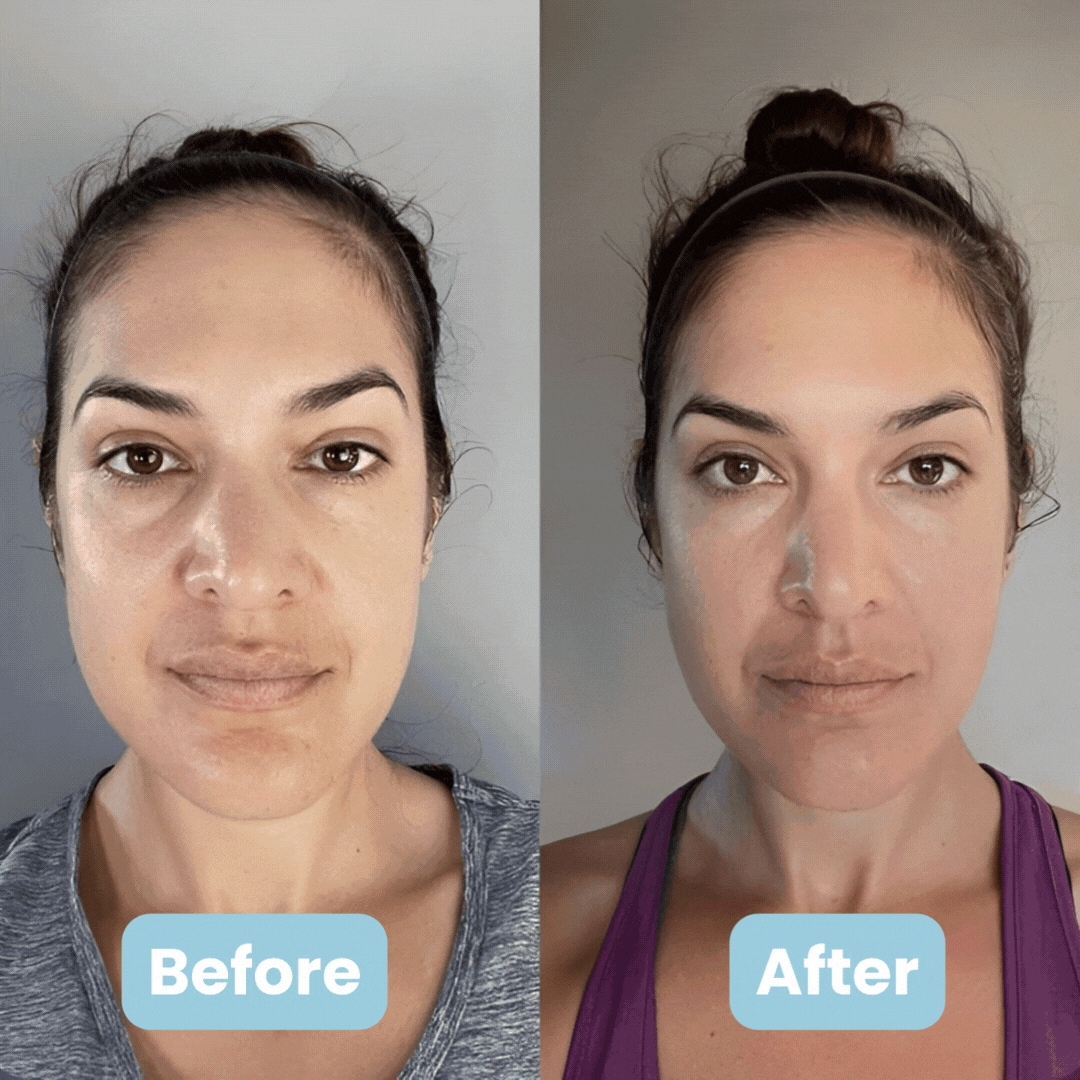 DERMAWELL 3-in-1 LED Facial Sculptor + 4 FREE Gifts